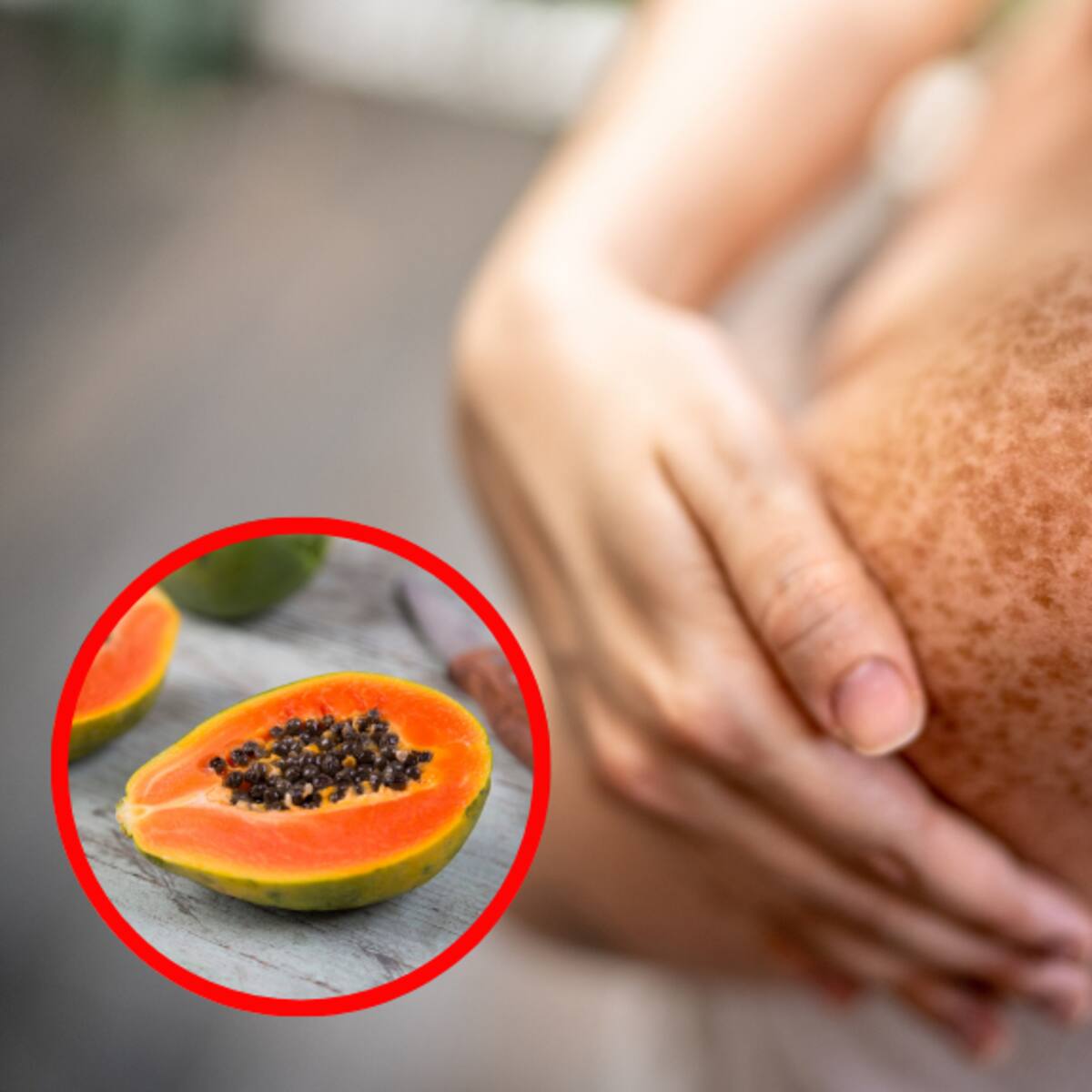 Lista: puré de papaya y más remedios caseros para aclarar la piel quemada por el sol