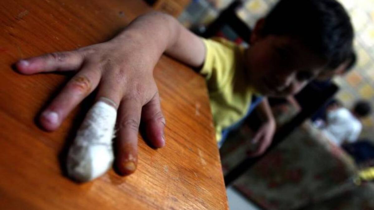 En ocho de los doce municipios del Quindío NO se han reportado quemados con pólvora