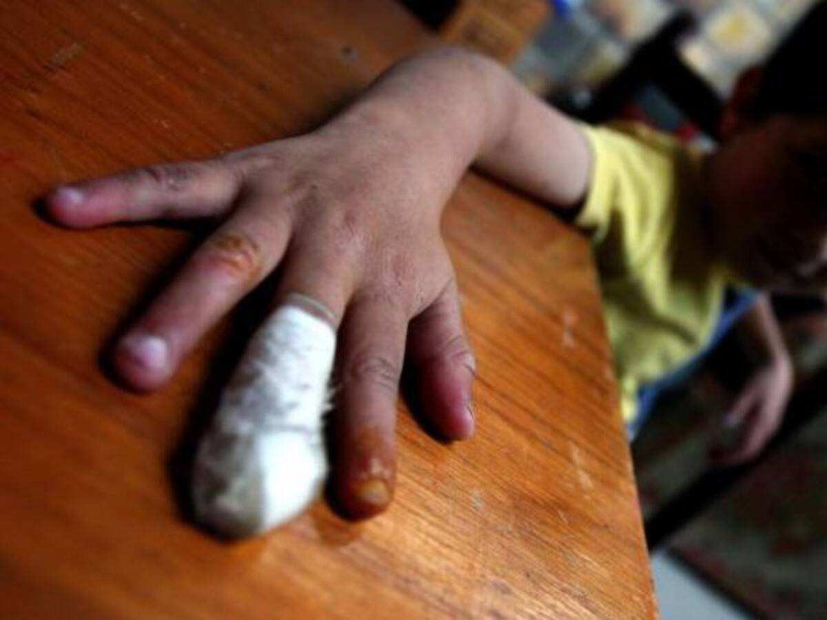 En ocho de los doce municipios del Quindío NO se han reportado quemados