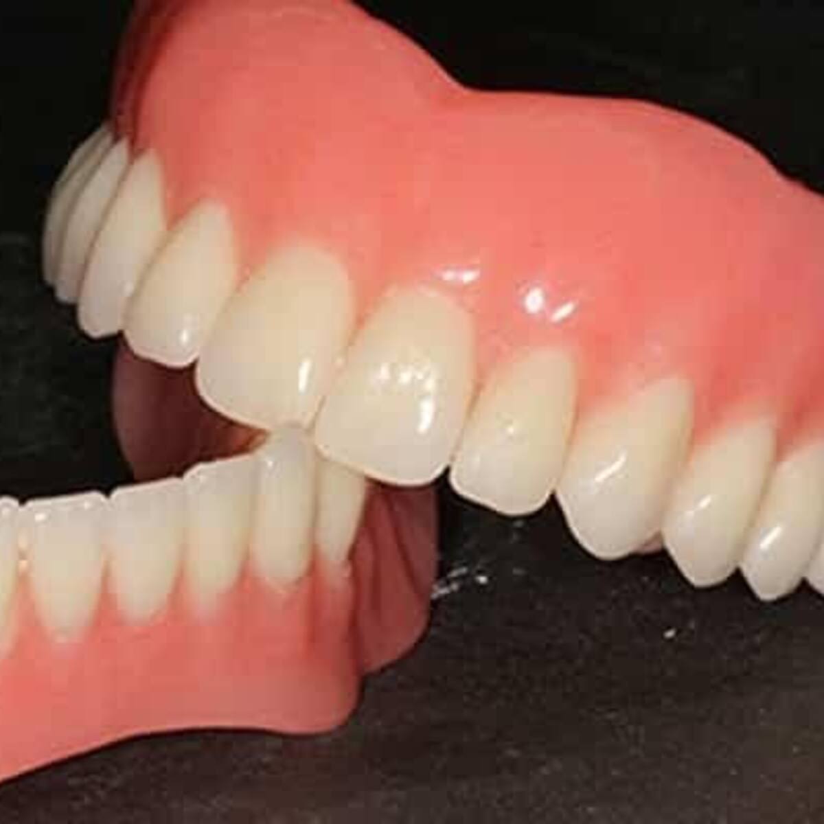 Mujer habría muerto por tragarse su propia prótesis dental en Armenia: esto se sabe