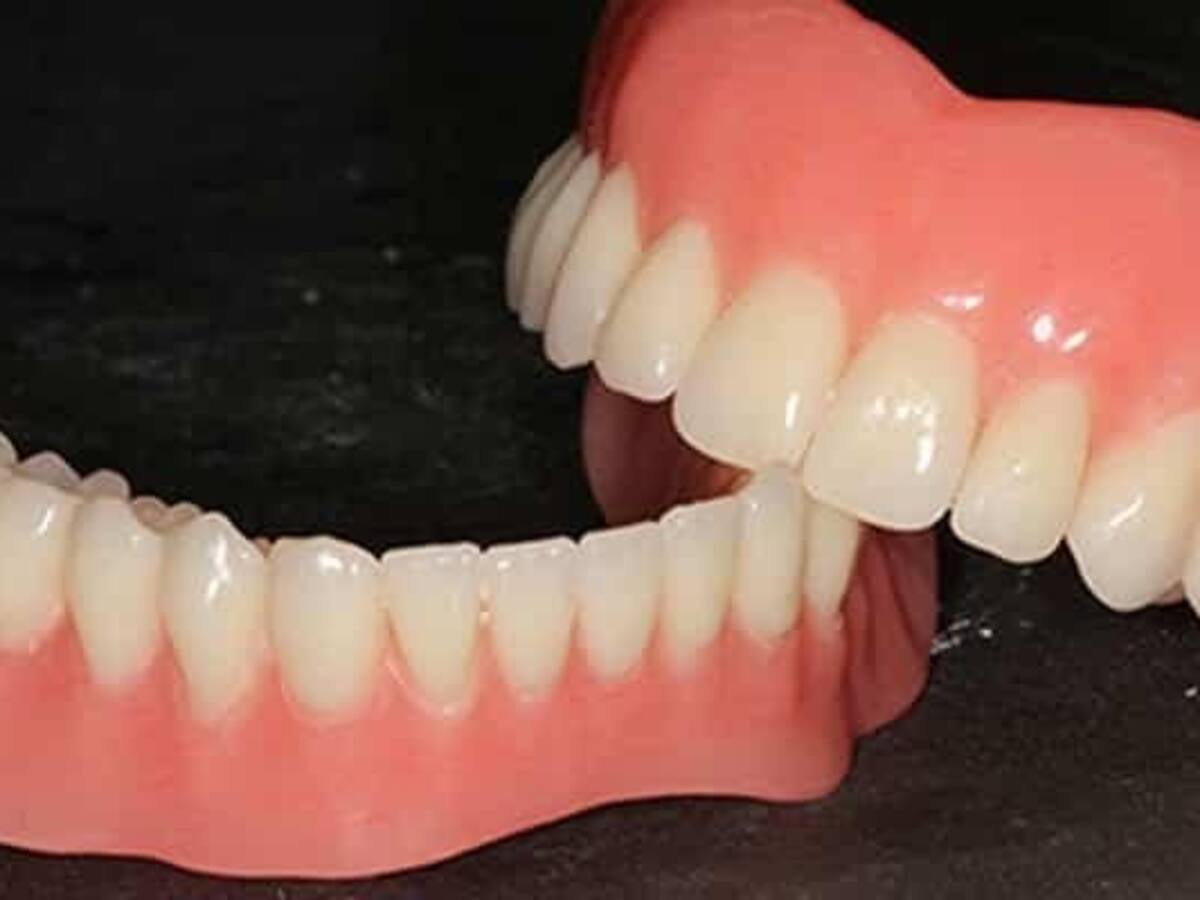 Mujer habría muerto por tragarse su propia prótesis dental en Armenia: esto se sabe