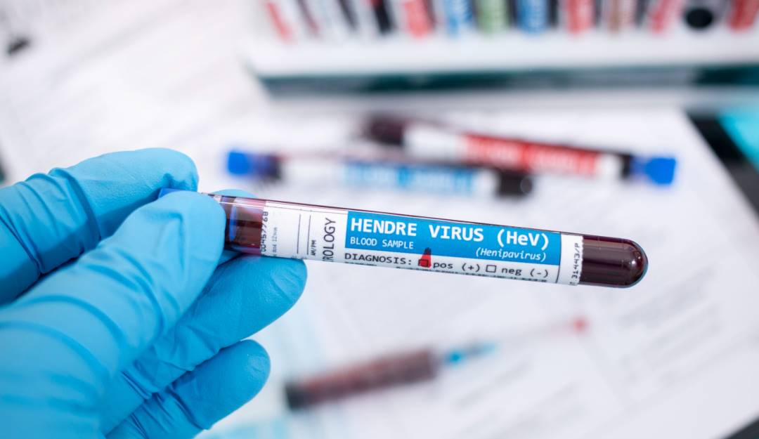 Henipavirus - Getty Images