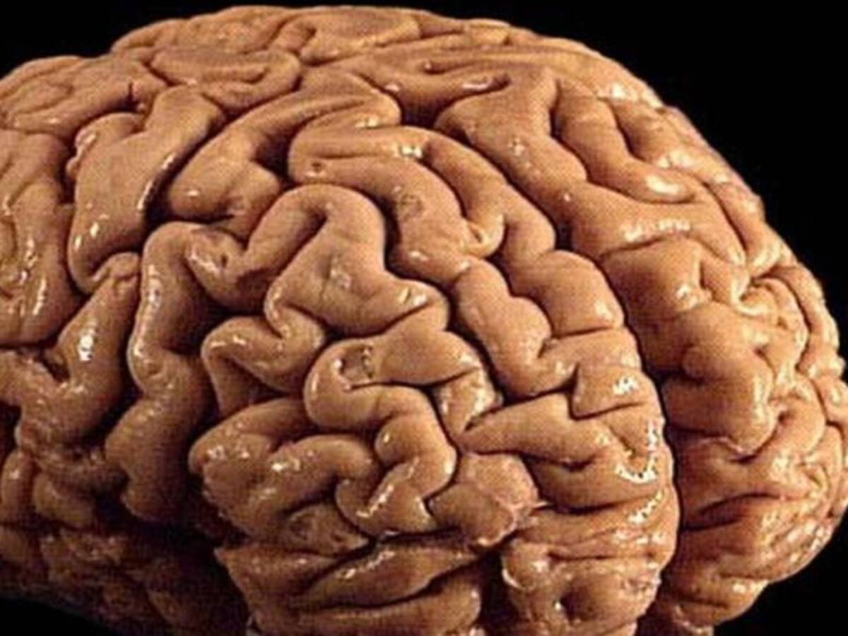 Logran hacer crecer cerebro humano en laboratorio de EE.UU.