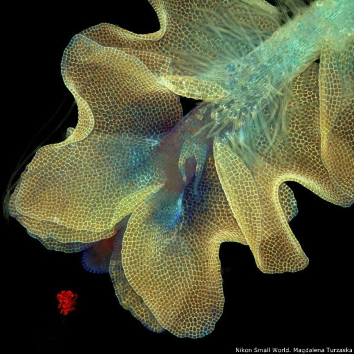 7º - Dr. Jan Michels, del Instituto de Zoología de la Universidad de Kiel (Alemania). Imagen de una almohadilla adhesiva en una pata delantera de una mariquita (Coccinella septempunctata).