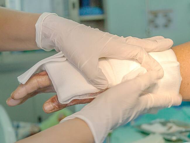 A la cárcel hombre que prendió fuego a su expareja