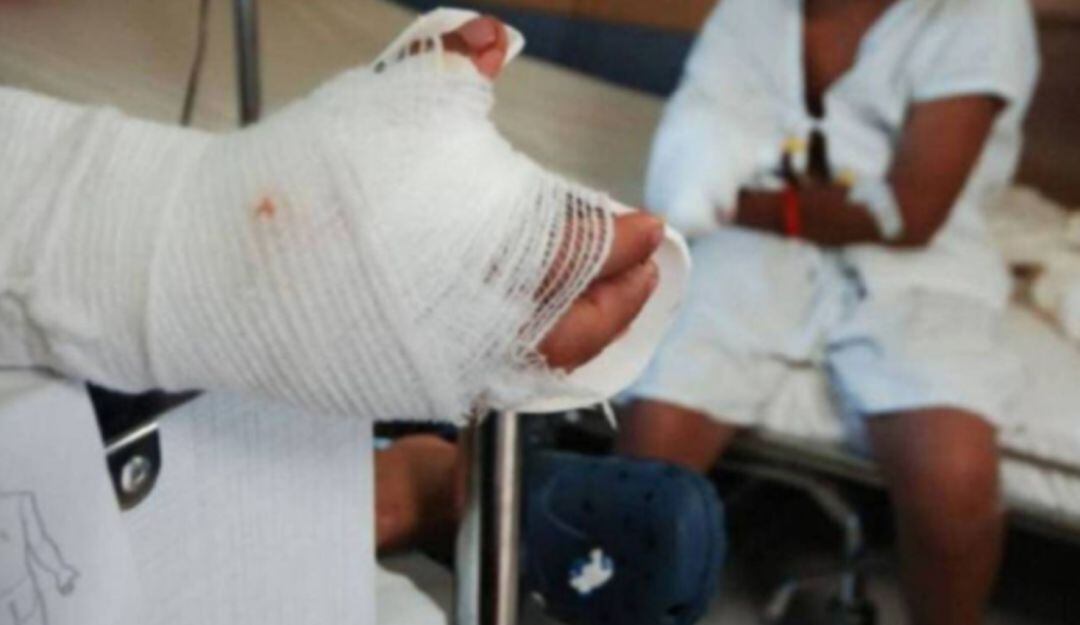 Los heridos fallecieron a causa de las quemaduras en sus cuerpos.