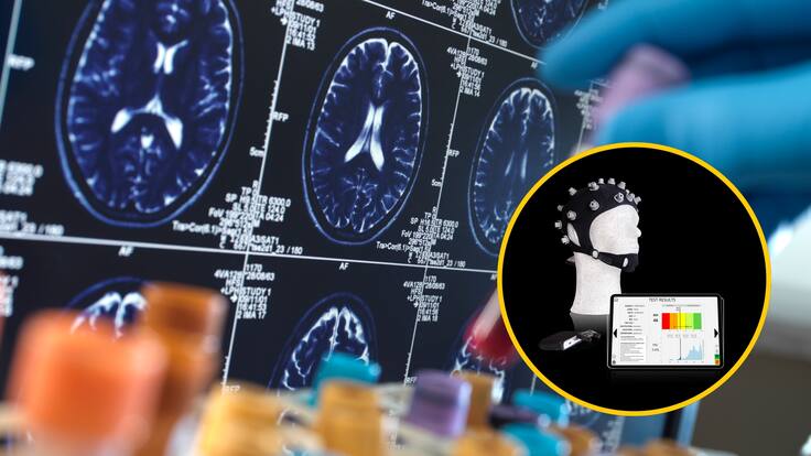 Gorro creado con IA busca detectar el Alzhéimer en su etapa inicial: así funcionaría