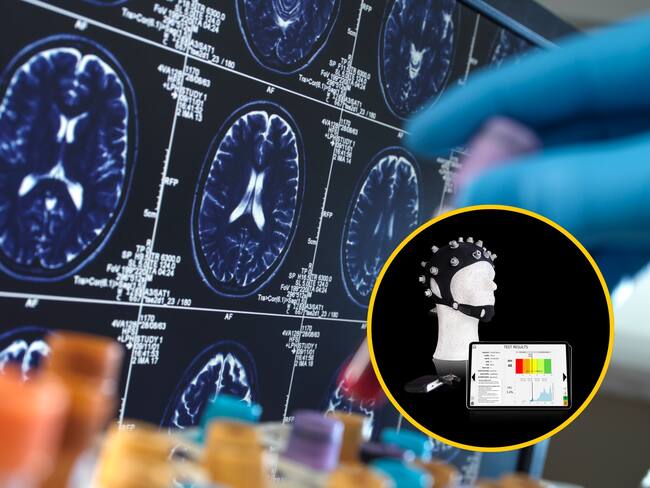 Gorro creado con IA busca detectar el Alzhéimer en su etapa inicial: así funcionaría