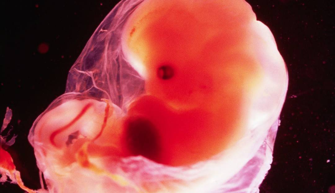 Un embrión humano en formación.            Foto: Getty 