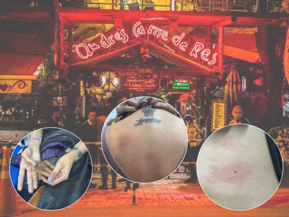 Reportan 9 heridos, pero hubo más que se fueron sin ser atendidos: Testigo caso Andrés Carne de Res