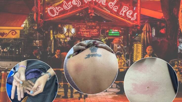 Reportan 9 heridos, pero hubo más que se fueron sin ser atendidos: Testigo caso Andrés Carne de Res