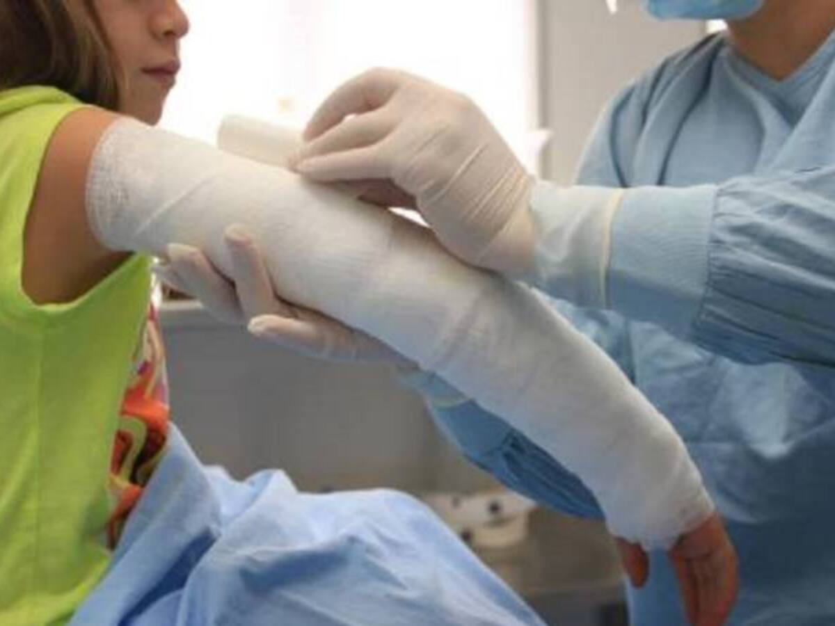 Cifra de quemados se redujo en fin de año