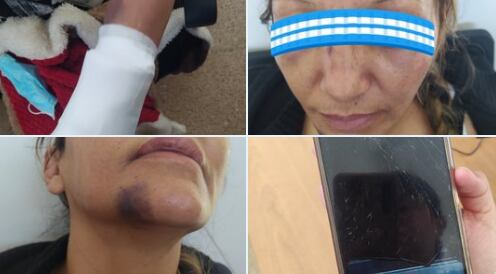 Mujer indígena presuntamente golpeada por policías de Suba. Foto: @ConejoErrante