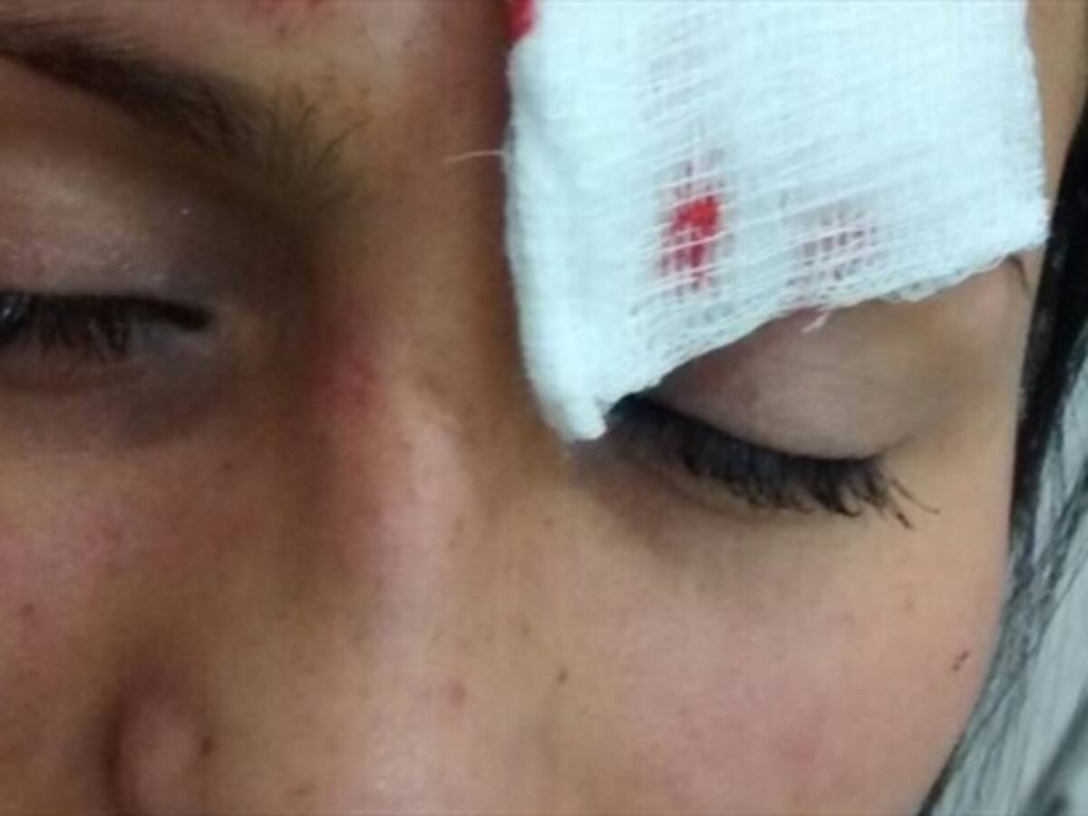 Mujer denuncia que fue golpeada en medio de un atraco en Transmilenio