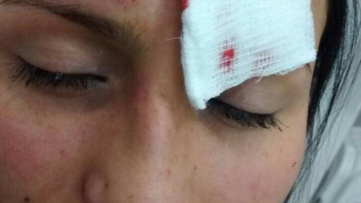 Mujer denuncia que fue golpeada en medio de un atraco en Transmilenio