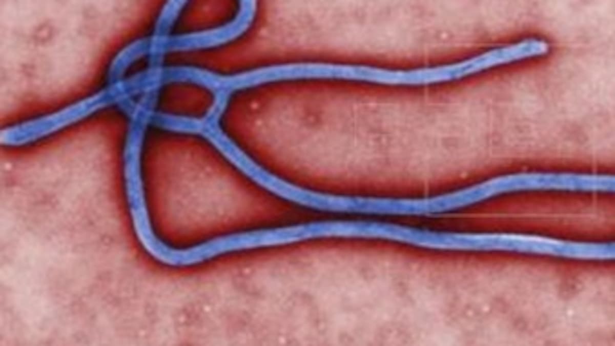 Ébola y Chicungunya: Dos virus que amenazan la salud