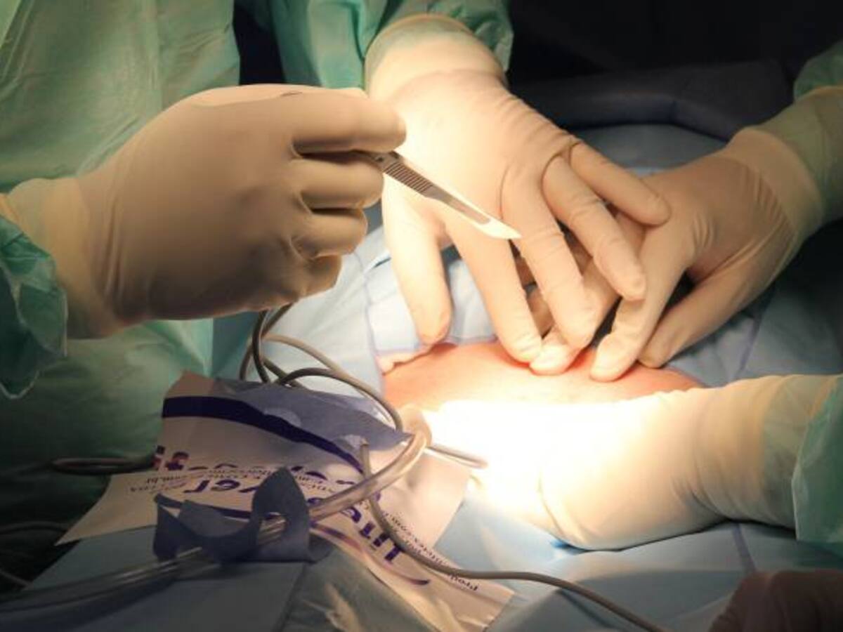 Muere estilista venezolano tras someterse a cirugía estética en Sincelejo