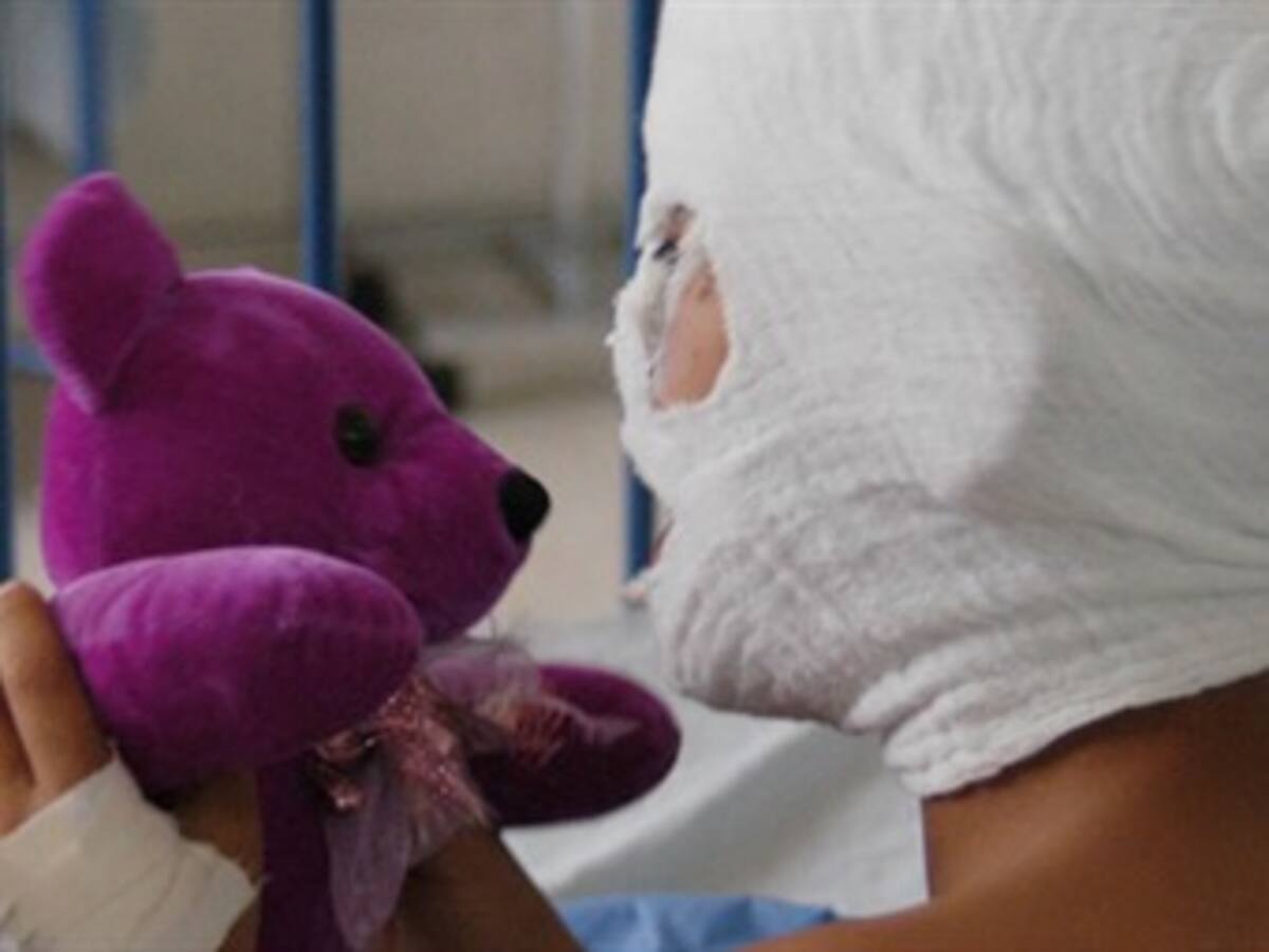Quince personas resultaron quemadas con pólvora en la noche de las velitas