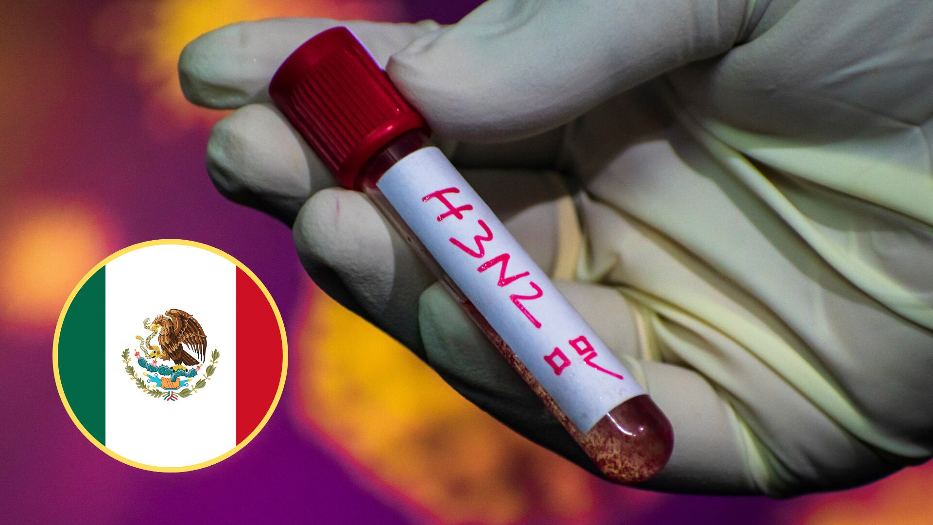 Autoridades sanitarias llaman la atención por el virus H3N2, / Foto imagen de referencia - Getty Images