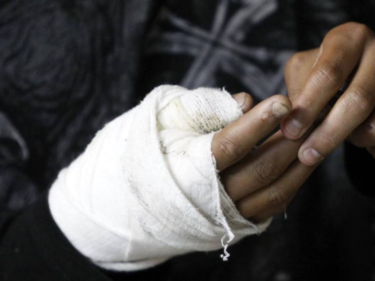 38 personas se han quemado con pólvora en Santander