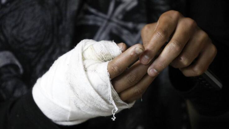 38 personas se han quemado con pólvora en Santander