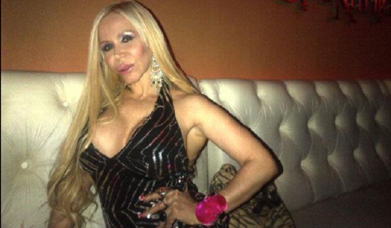 Alejandra Pradón se hizo un rejuvenecimiento vaginal en televisión