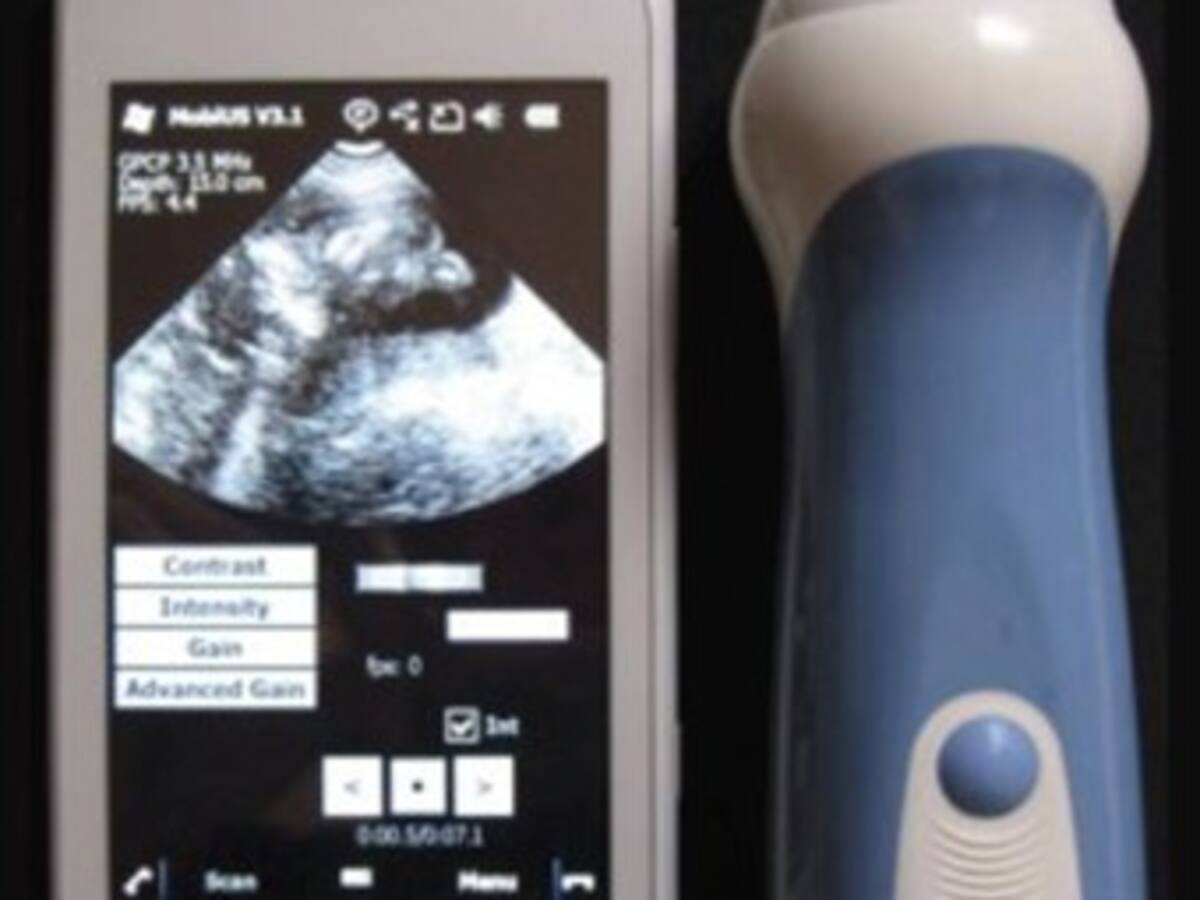 Ahora las ecografías pueden realizarse a través de un Smartphone