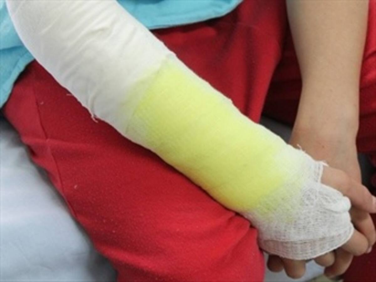 Ya van 500 quemados con pólvora en diciembre, 214 niños