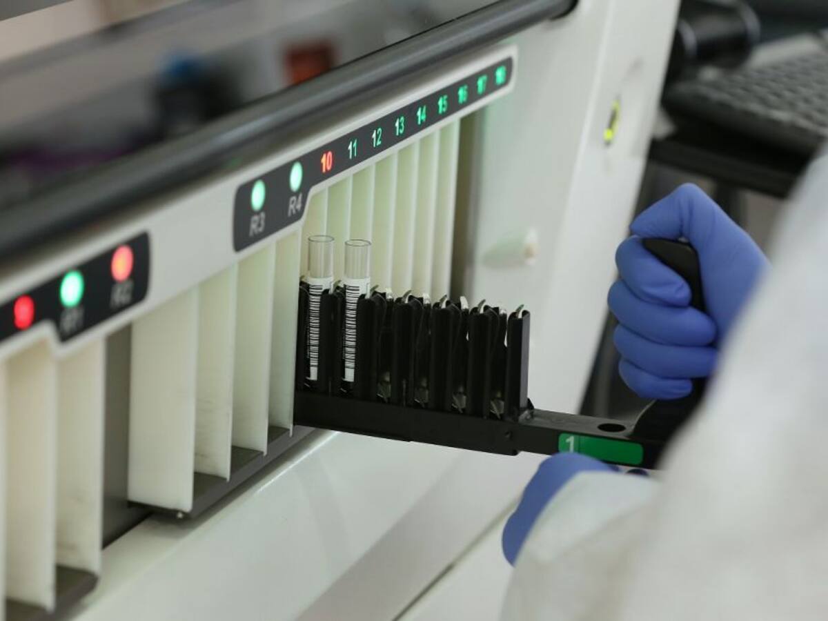 Confirman dos nuevos casos positivos de coronavirus en Sucre