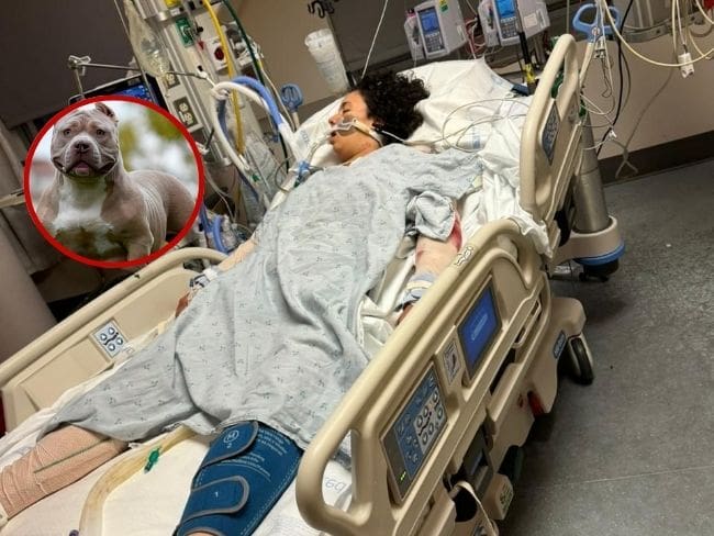 Santandereana grave en USA tras brutal ataque de dos perros American Bully XL