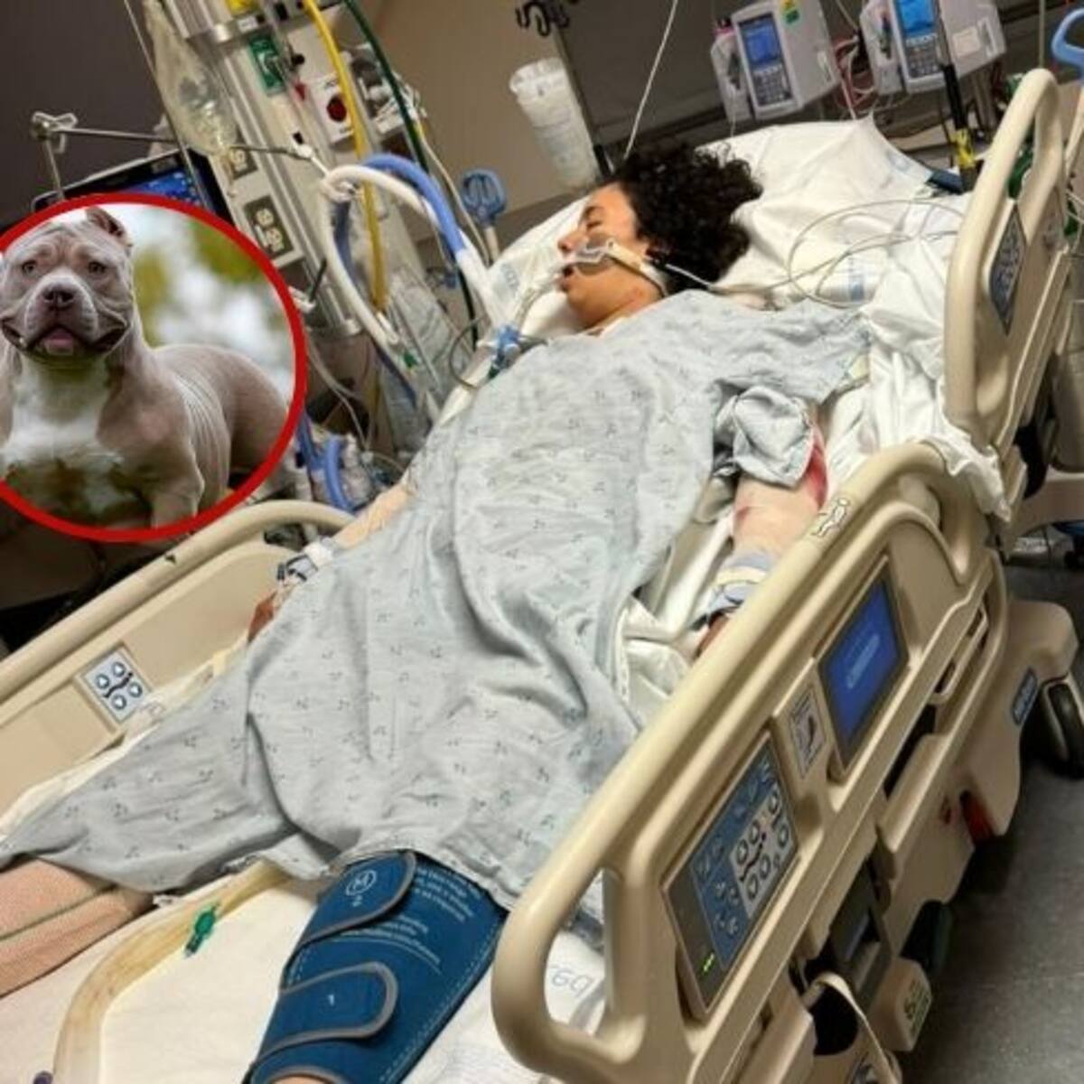 Santandereana grave en USA tras brutal ataque de dos perros American Bully XL