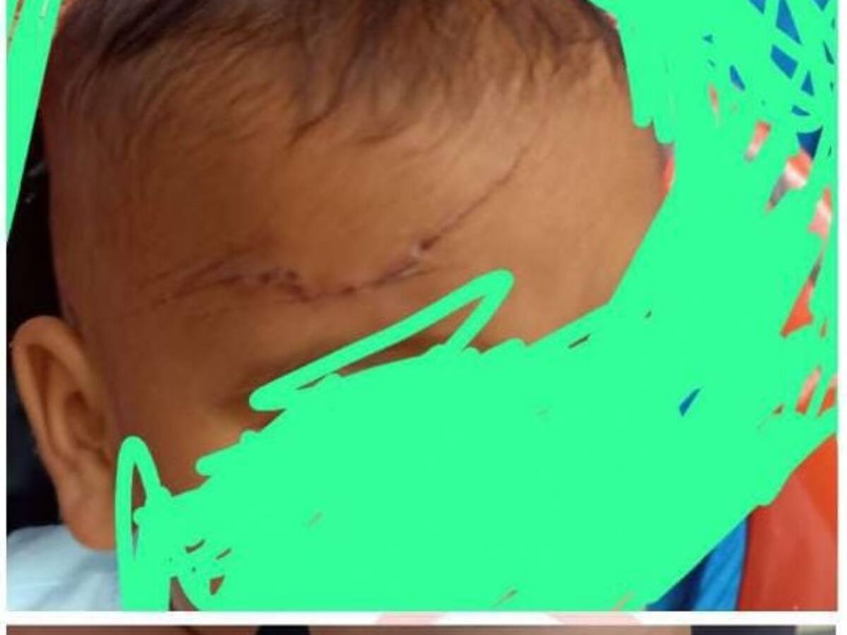 Denuncian que un bebé quedó lesionado con esquirlas de una granada en Remedios