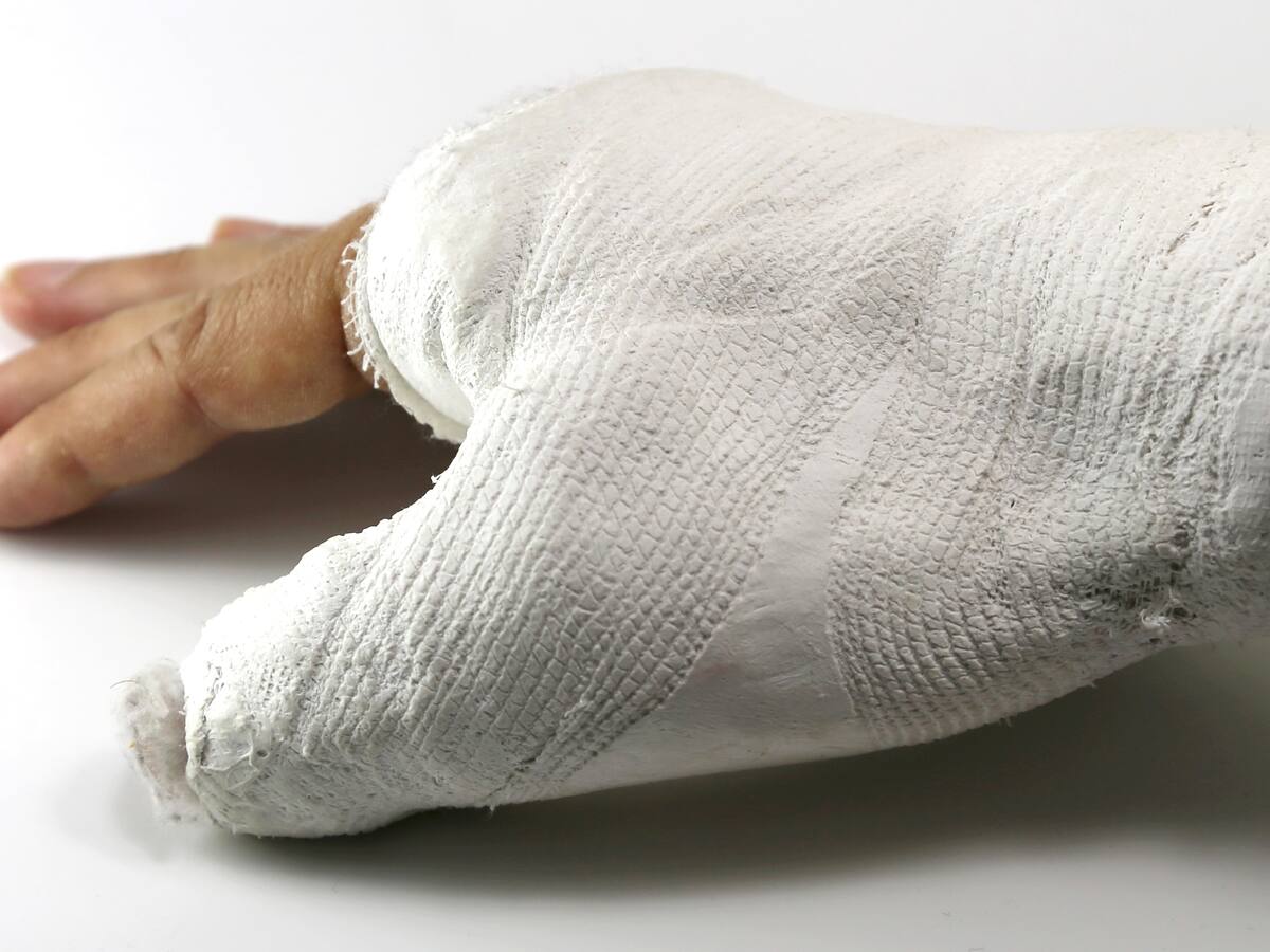 Joven de 17 años sufrió quemaduras en 90% de su cuerpo en incendio en atracción en Calarcá, Quindío