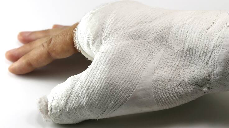 Joven de 17 años sufrió quemaduras en 90% de su cuerpo en incendio en atracción en Calarcá, Quindío