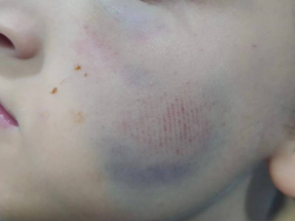 Denuncian que un profesor golpeó con su rodilla a estudiante en Pensilvania, Caldas