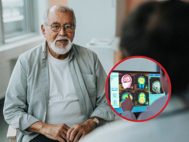 ¿El cerebro podría rejuvenecer? // Getty Images //