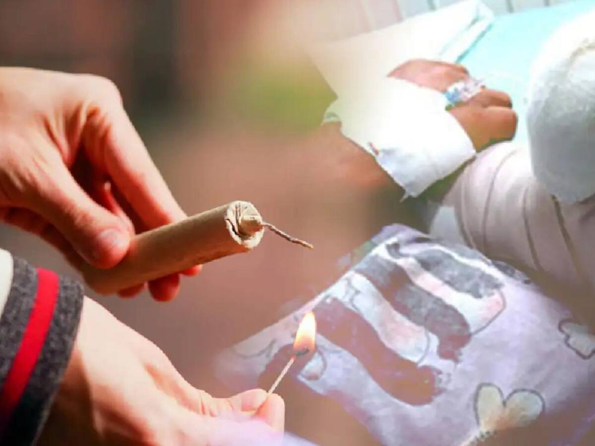 El Huila suma 48 quemados por pólvora pirotécnica en el inicio de 2.025.