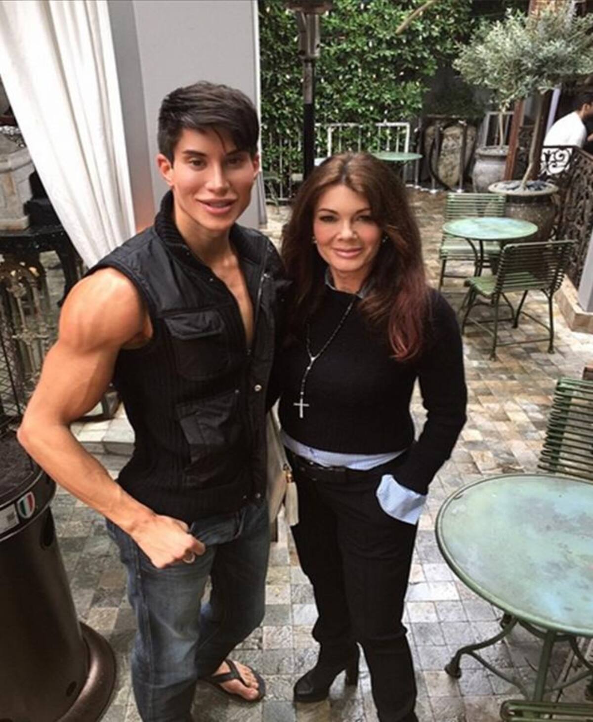 Justin Jedlica se operó para remover tres venas de su frente, intervención que lo pudo dejar ciego. Fotos: Instagram.