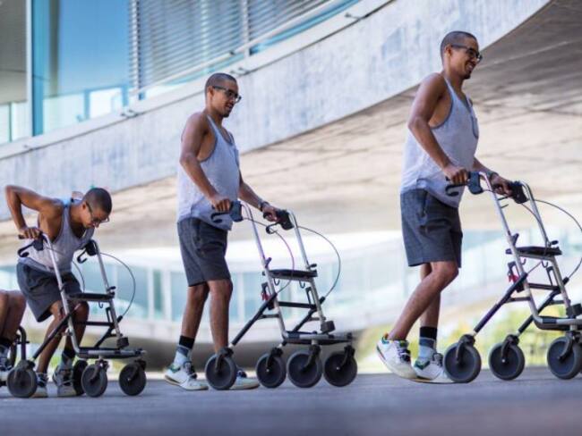 Implante electrónico les permite caminar a tres pacientes parapléjicos