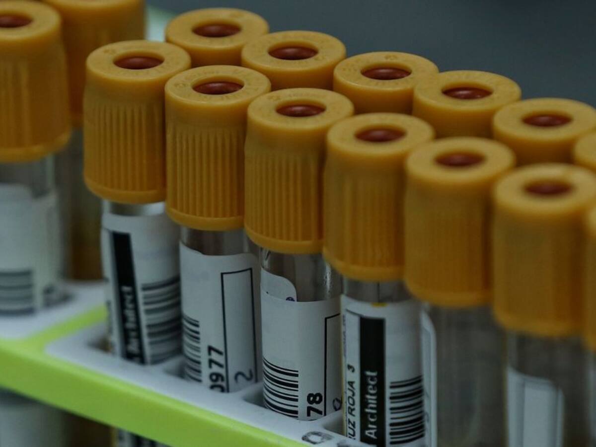 El Coronavirus ya hace presencia en 27 municipios de Bolívar