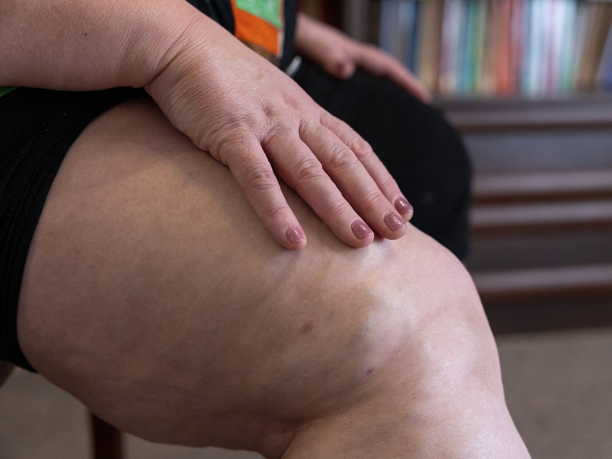 5 diuréticos naturales para retención de líquidos: cómo prepararlos y cuándo consumirlos