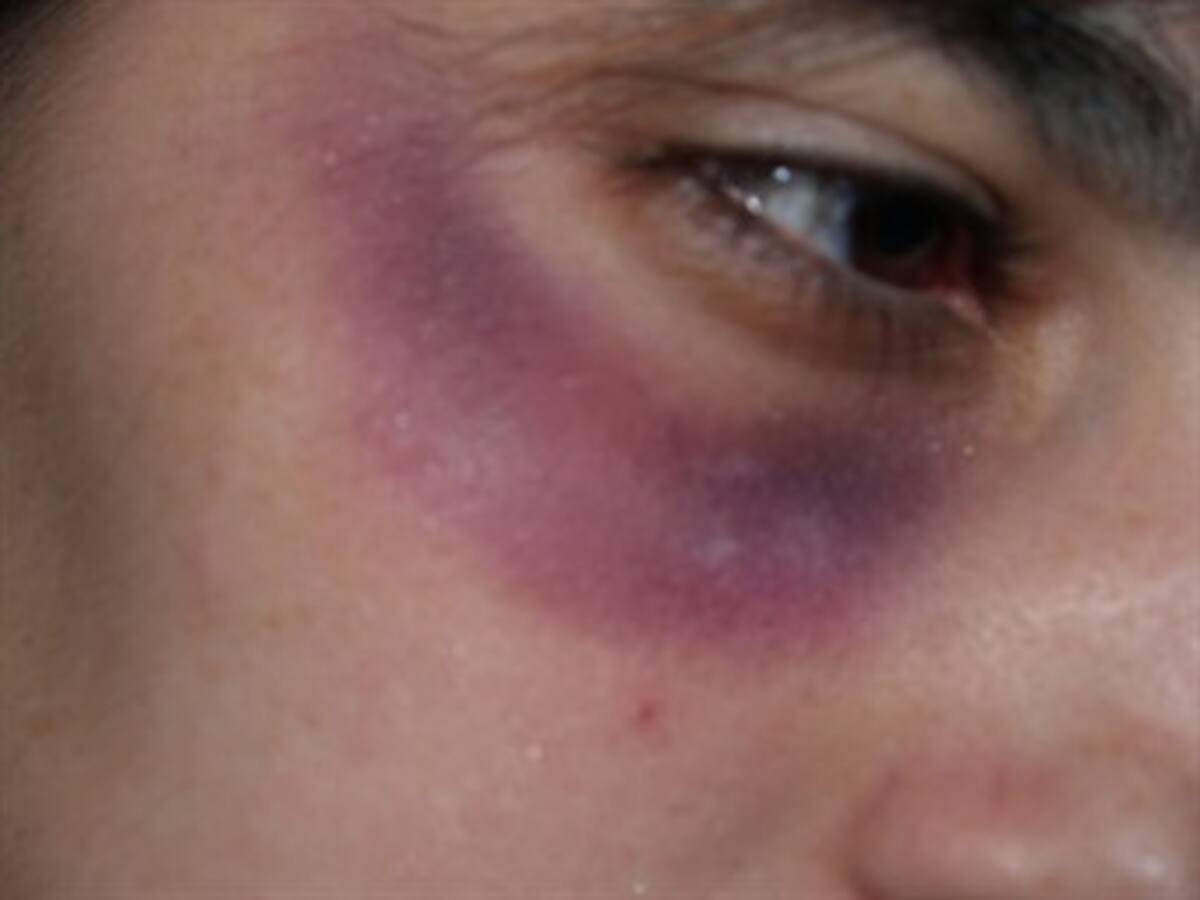 A golpes, profesor agrede a estudiante de derecho en Universidad de Montería