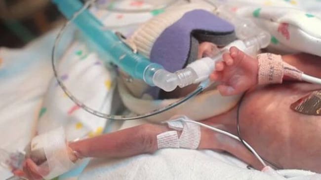 Los padres piden a la Eps garantizar la vida de su hijo.