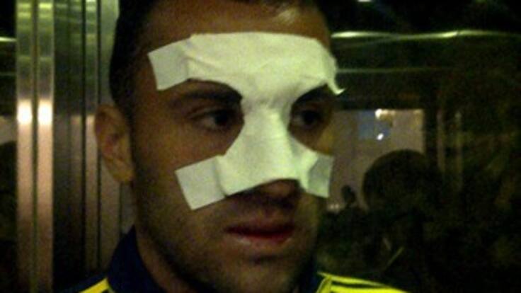 David Ospina abandonó el Hospítal donde le fue reducida su fractura de tabique nasal