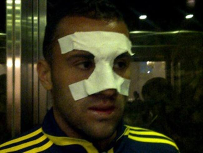 David Ospina abandonó el Hospítal donde le fue reducida su fractura de tabique nasal