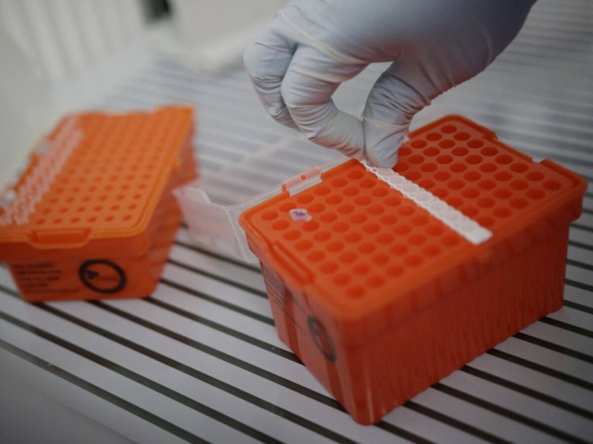 Bolívar registra 36 casos de tuberculosis en lo que va del 2022