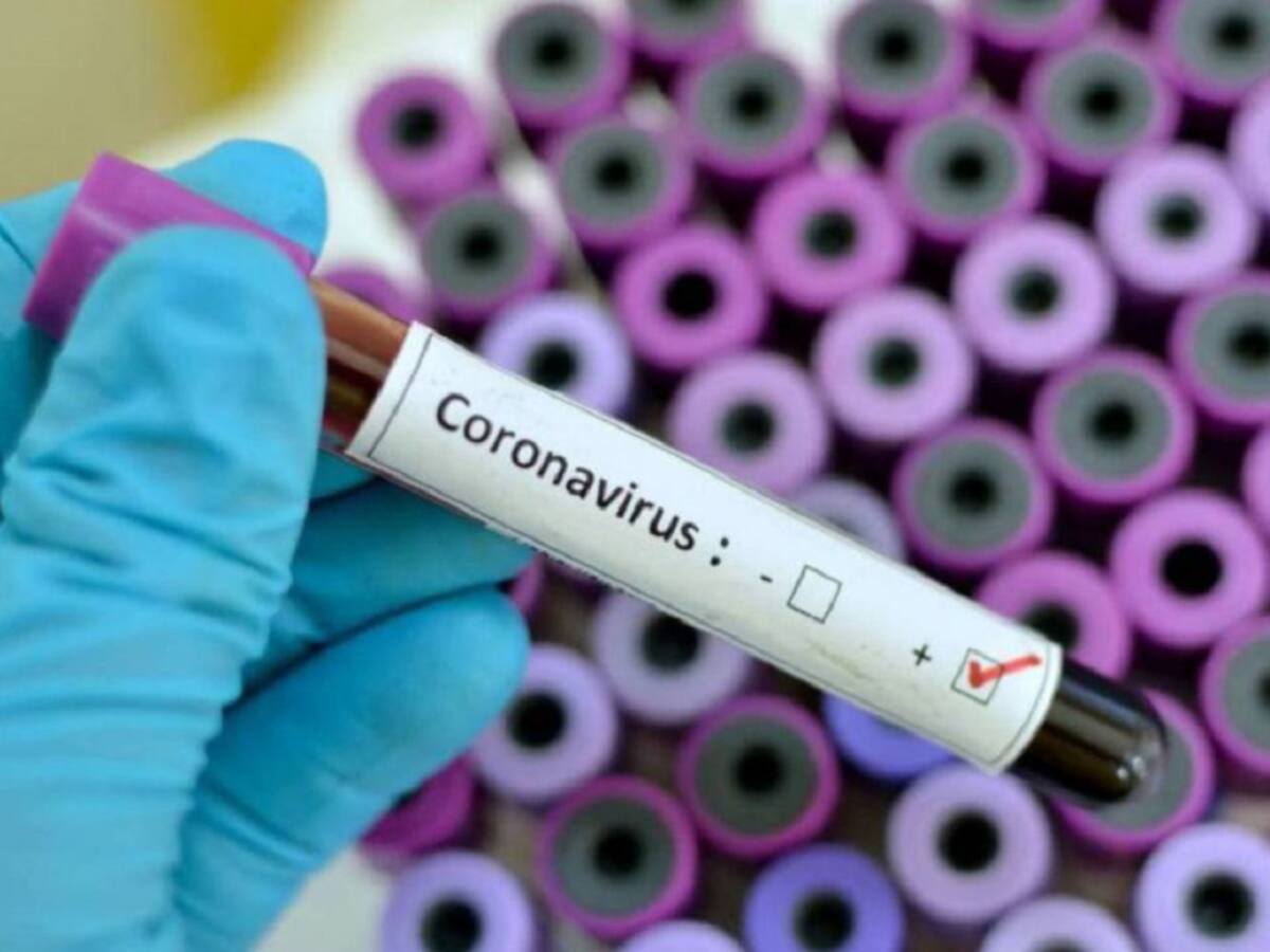 Concejales reclaman al alcalde mayor respuesta frente al coronavirus