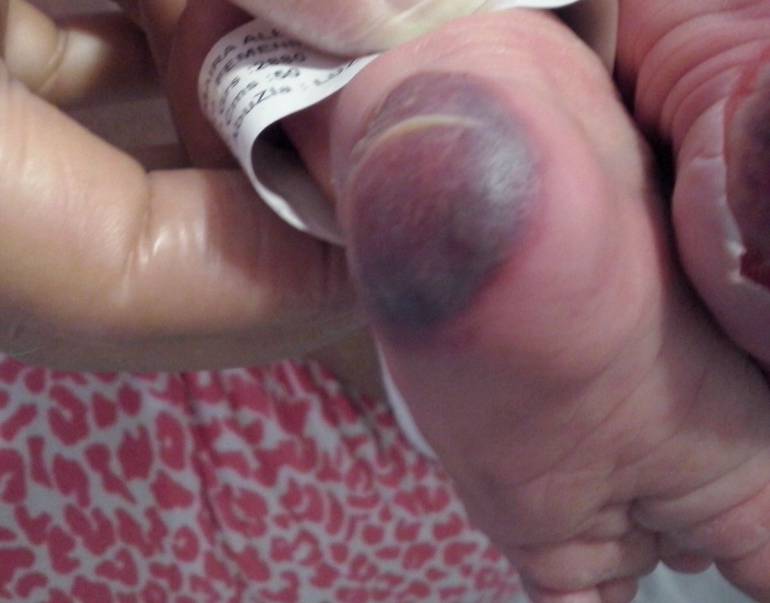 Denuncia procedimiento médico en Antioquia