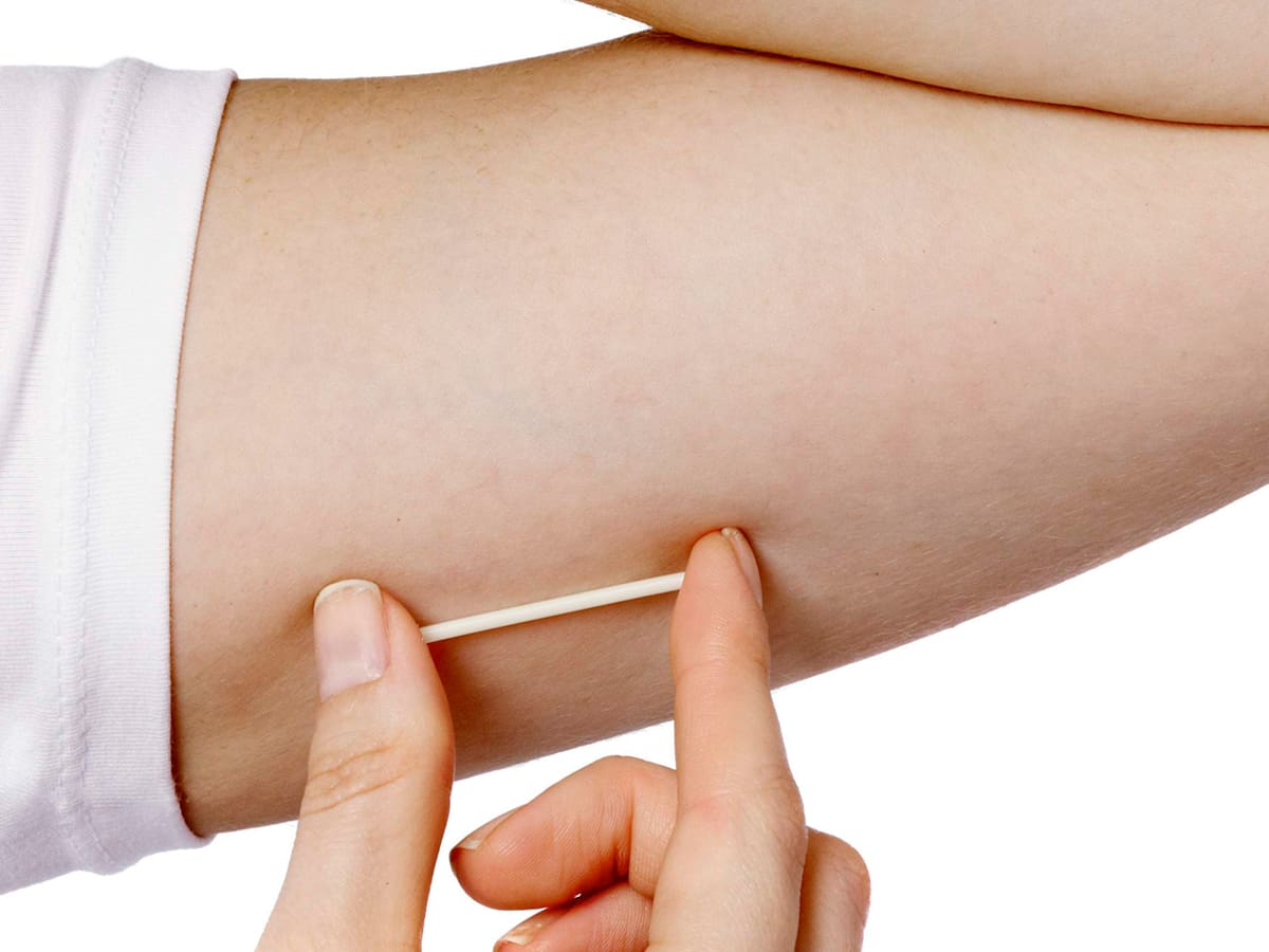 La Secretaría de Salud de Sogamoso aclara polémica por anticonceptivo en menor de 12 años.