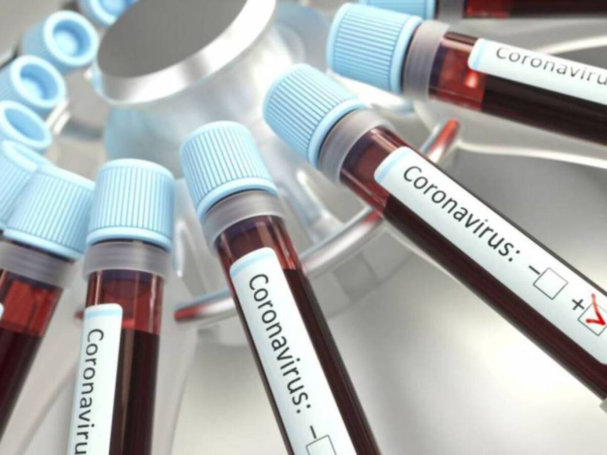 Confirman primer caso de Covid-19 en Risaralda